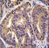 GTF2H2C Antibody (aa314-343)