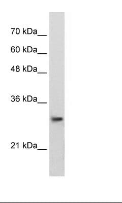 PSMA1 Antibody (aa170-219)