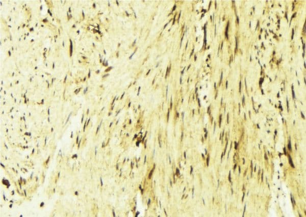 Polyclonal Rabbit anti-Human CaMKII Beta+Gamma+Delta Antibody (phospho-Thr287, IHC, WB)