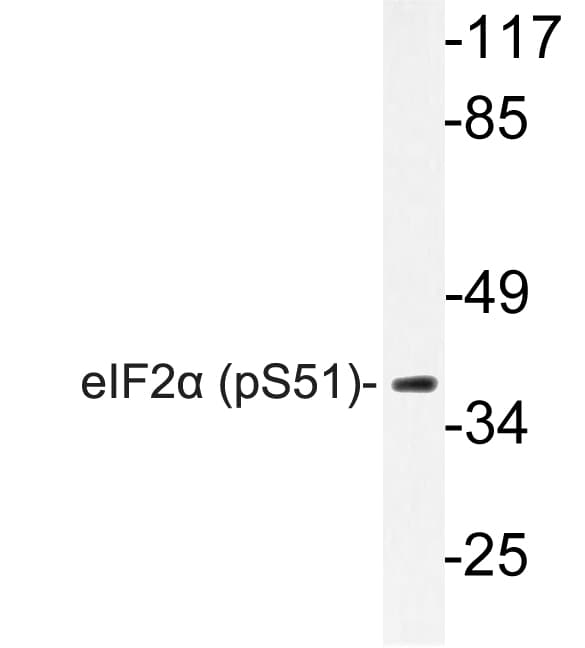 EIF2S1 Antibody (phospho-Ser51)
