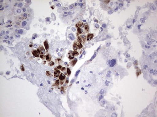 Nor-1 / NR4A3 Antibody (aa332-626, clone OTI2E1)