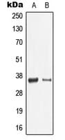 LGALS9 / Galectin 9 Antibody (Internal)