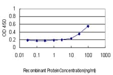 PRKAB2 / AMPK Beta 2 Antibody (clone 2G9)