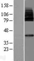 MFSD2A Protein (Over-Expression Lysate Myc-DDK (Flag))