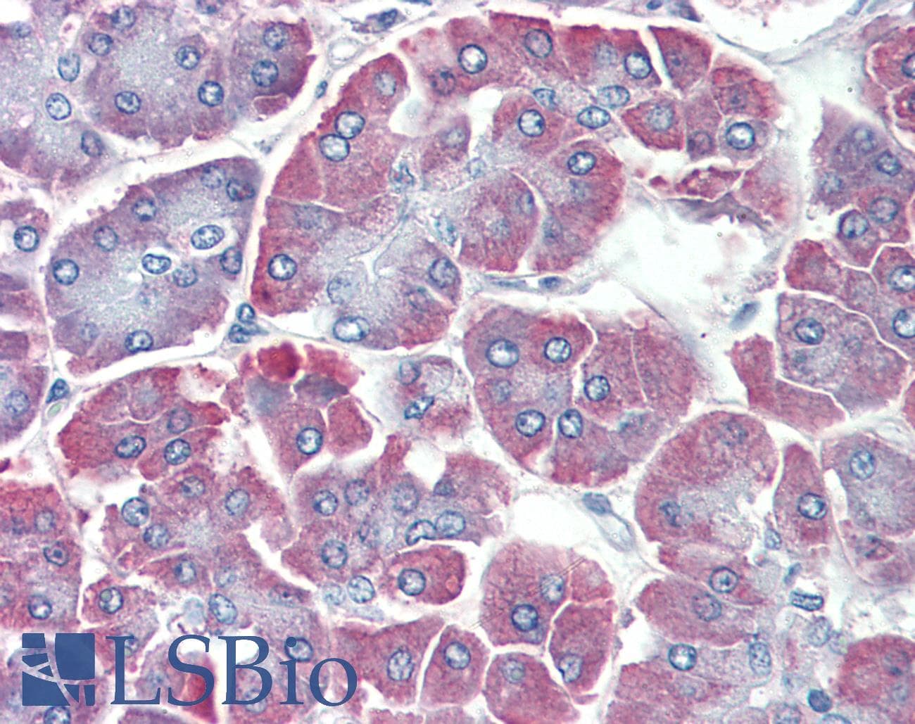 PathPlus™ Polyclonal Rabbit anti-Human BACE2 Antibody (IHC, WB)