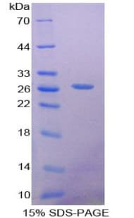 Rat SOX18 Protein (Recombinant His-T7)