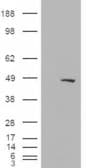 IHC-plus™ SMARCE1 / BAF57 Antibody (aa364-376)
