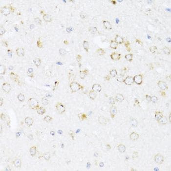 ALOX12 / 12 Lipoxygenase Antibody