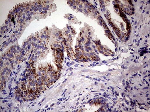 Monoclonal Mouse anti-Human PDSS2 / DLP1 Antibody (clone UMAB177, IHC, WB)