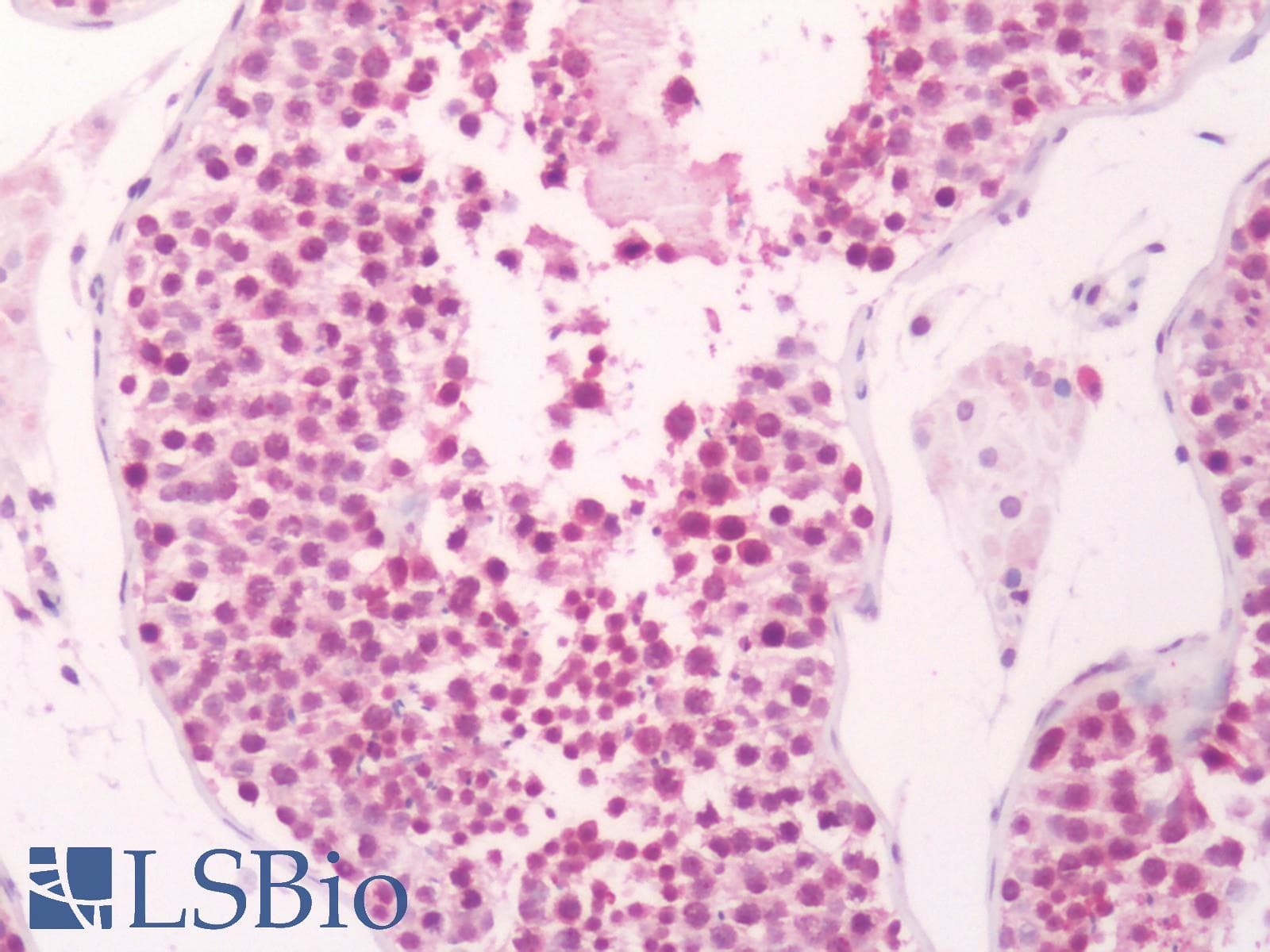 PathPlus™ Polyclonal Rabbit anti-Human PGES / PTGES Antibody (Cytoplasmic Domain, IHC)