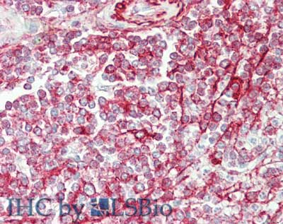 Polyclonal Rabbit anti-Human NCOA3 / SRC-3 / AIB1 Antibody (IHC, WB)