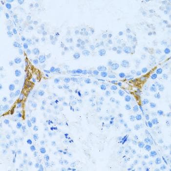 KLHL42 / KLHDC5 Antibody