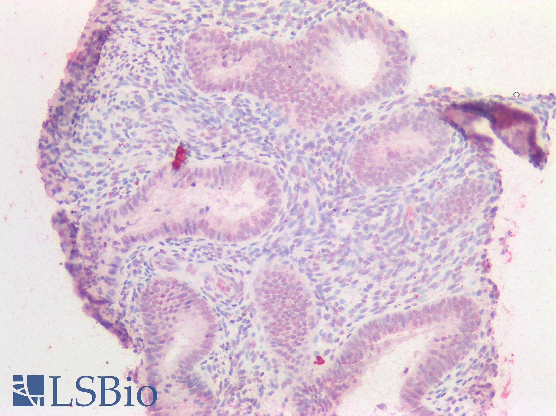 IHC-plus™ Polyclonal Goat anti-Human HOXA5 Antibody (IHC, WB)