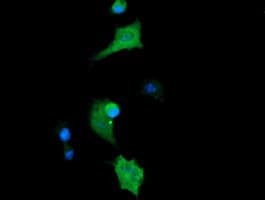 CTAG1B / NY-ESO-1 Antibody (clone OTI2B4)