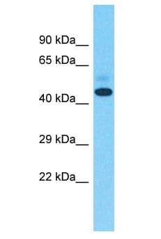 ZNF735 Antibody (aa151-200)