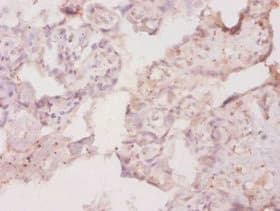 CSF1R / CD115 / FMS Antibody