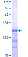Human SHANK2 / SHANK Protein (Recombinant GST, N-terminus)