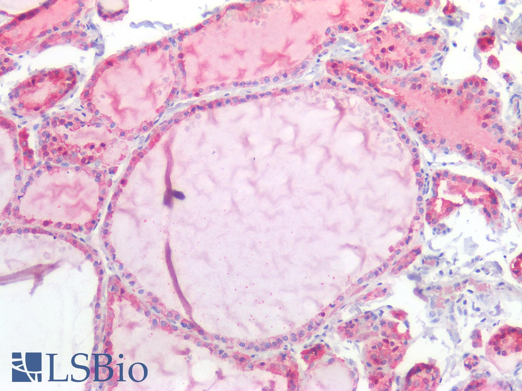 PathPlus™ CDH1 / E Cadherin Antibody (C-Terminus)