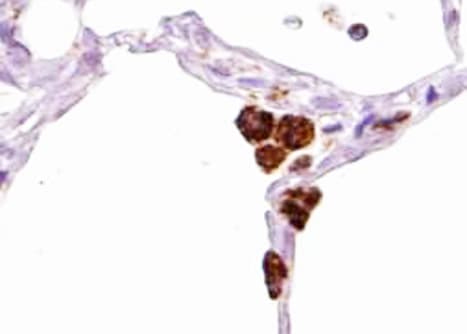 PTPN6 / SHP1 Antibody (phospho-Tyr536)