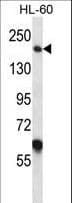 MYOM1 / Myomesin 1 Antibody (aa904-933)
