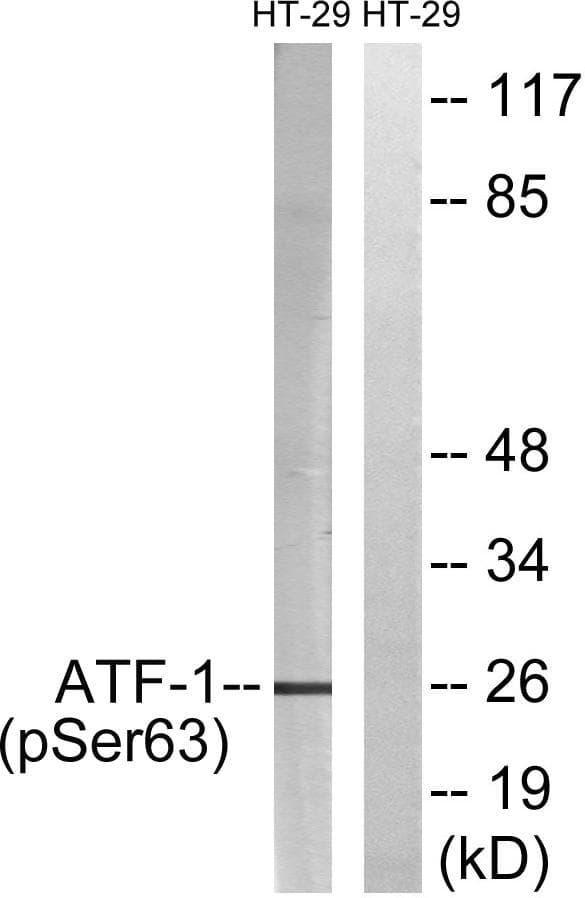 ATF1 Antibody (phospho-Ser63)