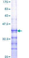 Human RORA / ROR Alpha Protein (Recombinant GST, N-terminus)