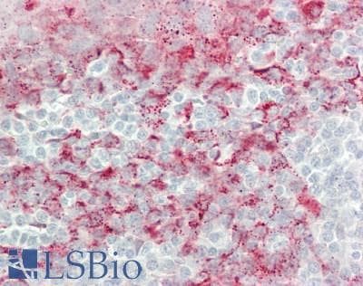 IHC-plus™ MAC-2-BP / LGALS3BP Antibody (clone 5E3)