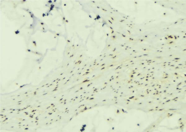 CAMK2B / CaMKII Beta Antibody