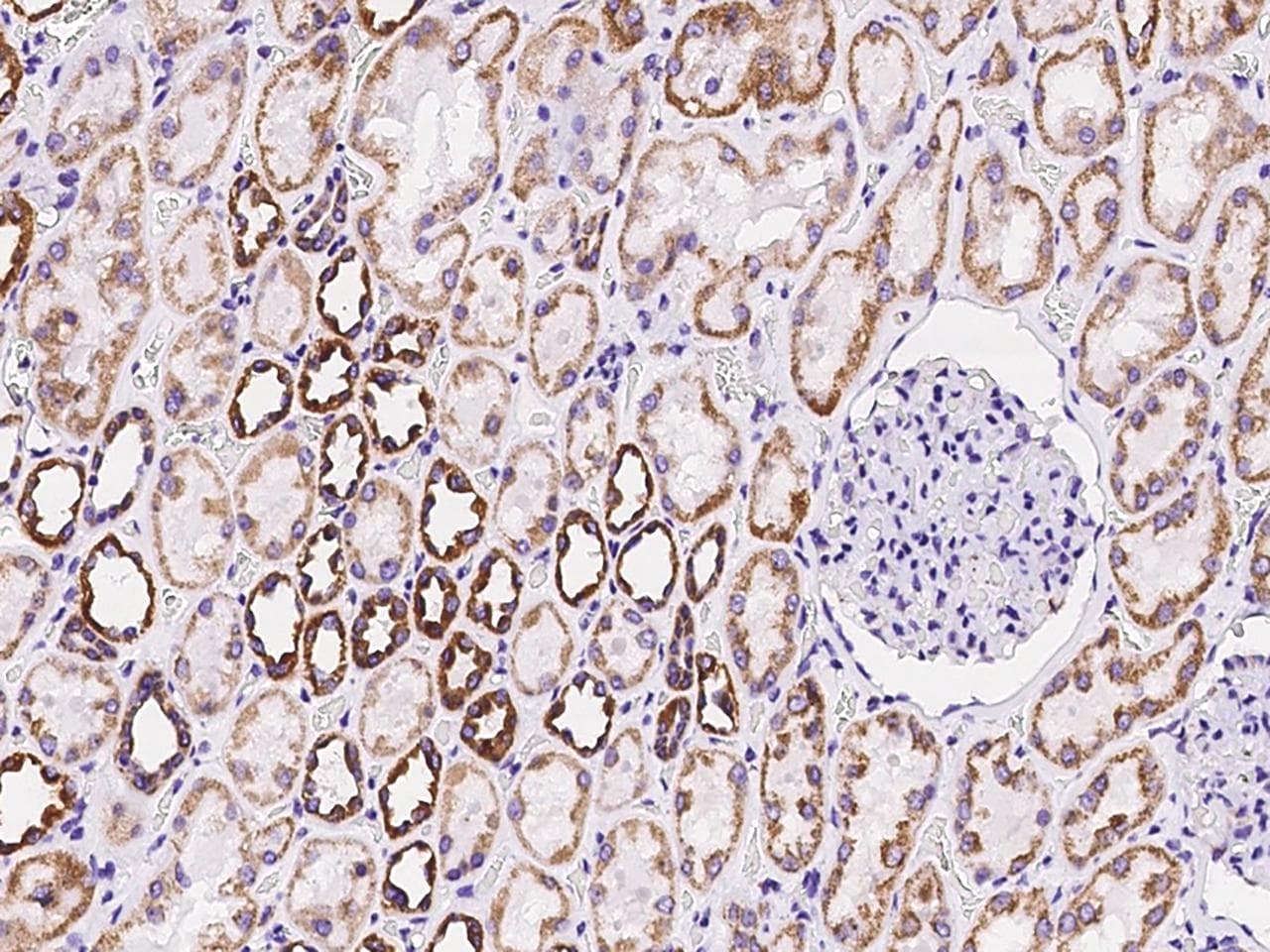 ATP5O Antibody