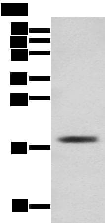 TNNC1 / Cardiac Troponin C Antibody