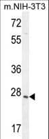 ZCCHC17 / PNO40 / PS1D Antibody (aa159-187)