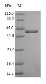 Bacillus subtilis Penicillin-binding protein 4 (Recombinant 6His-SUMO, N-terminus)