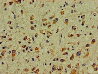 DCLK / DCLK1 Antibody