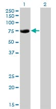 CBFA2T2 / MTGR1 Antibody (clone 2C10)