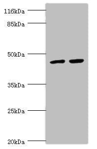 Polyclonal Rabbit anti-Human TRIM13 Antibody (IHC, WB)