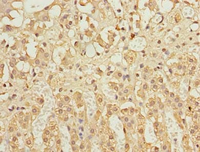 Polyclonal Rabbit anti-Human CFLAR / FLIP Antibody (IHC, WB)
