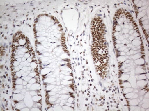 Monoclonal Mouse anti-Human CWC27 Antibody (clone OTI4C8, aa145-472, IHC, WB)