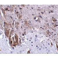 Polyclonal Rabbit anti-Human LRFN1 Antibody (IHC, IF, WB)