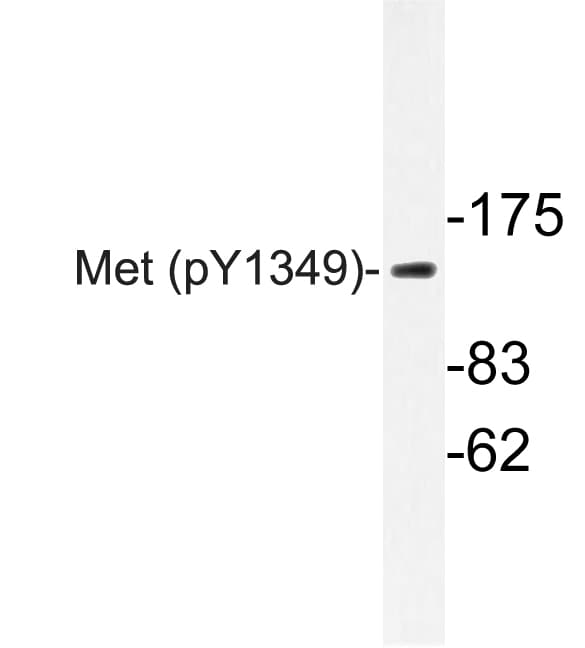 c-Met Antibody (phospho-Tyr1349)