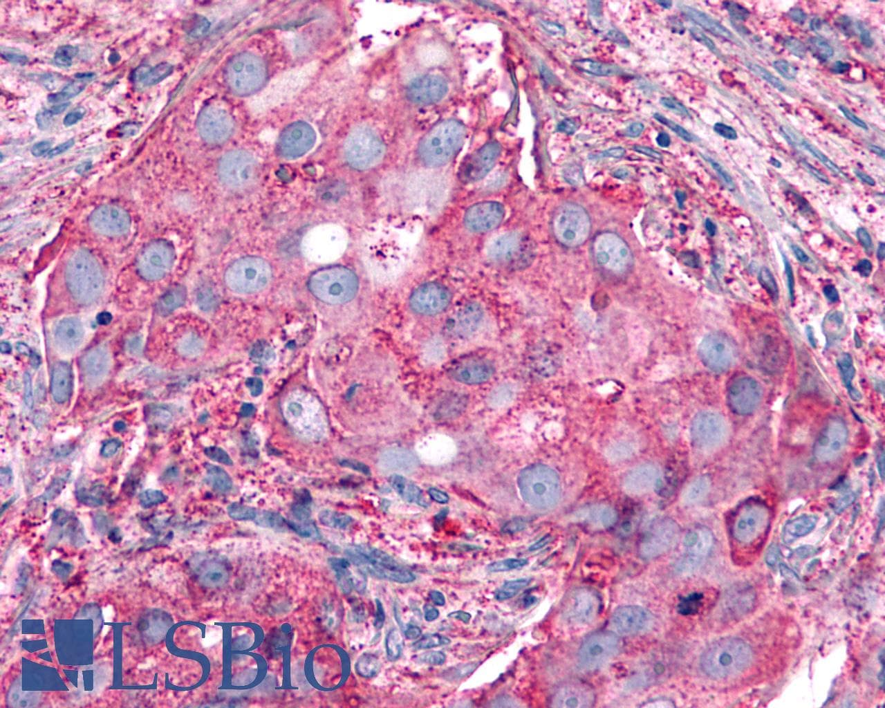 PathPlus™ Polyclonal Rabbit anti-Human P2RY6 / P2Y6 Antibody (Cytoplasmic Domain, IHC)