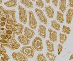 CD209 / DC-SIGN Antibody