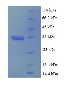 Human Dynactin 3 / DCTN3 Protein (Recombinant His-SUMO)