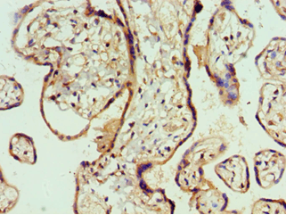 AMOT / Angiomotin Antibody (aa1-300)