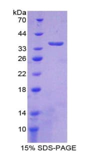 Human NT5C3A Protein (Recombinant His-T7)