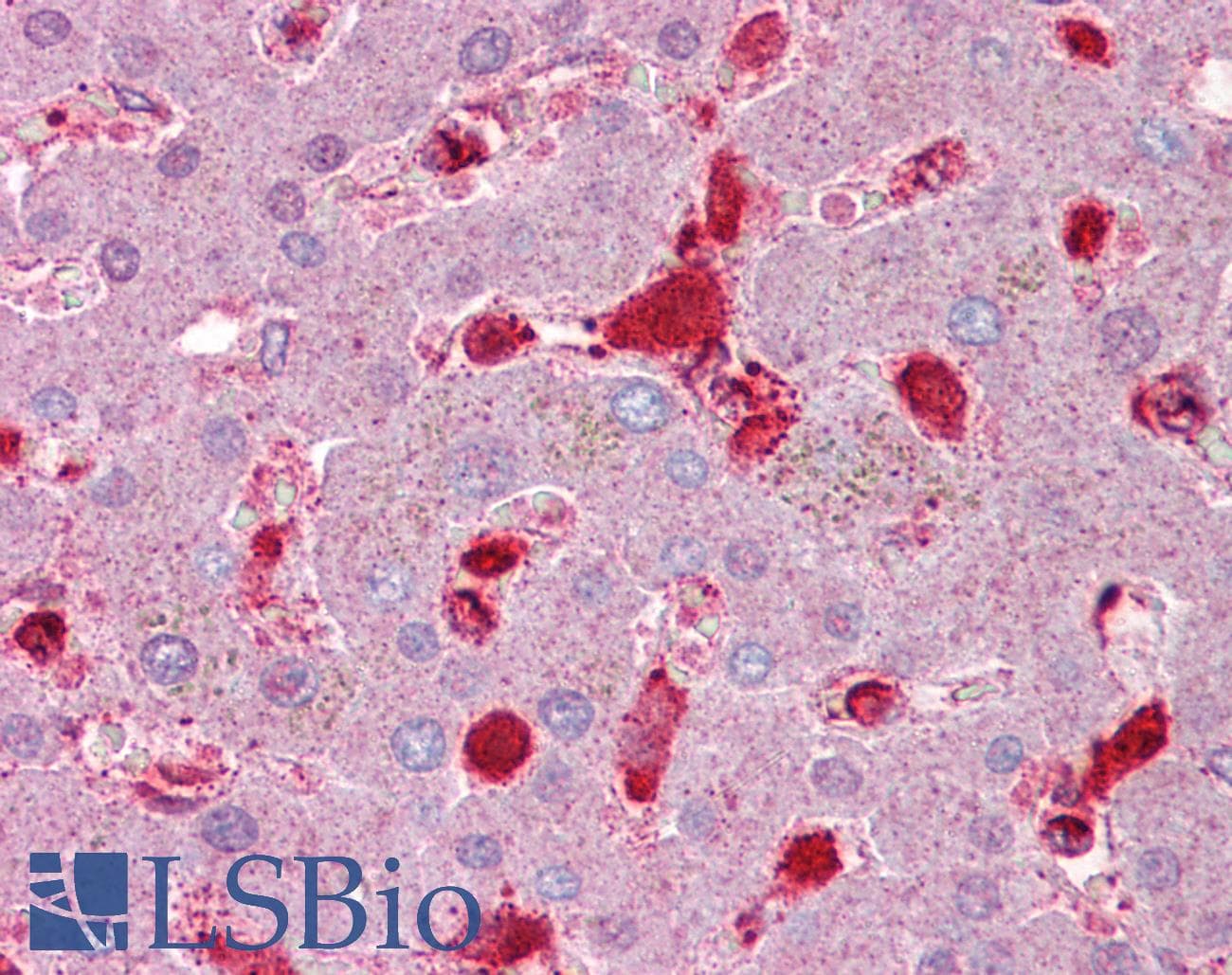 Polyclonal Rabbit anti-Human Antithrombin-III Antibody (aa143-192, IHC, WB)