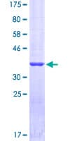 Human SFTPA1 / Surfactant Protein A (Recombinant GST)