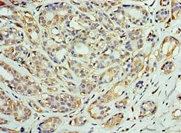 DNAJC2 / ZRF1 Antibody (aa1-140)