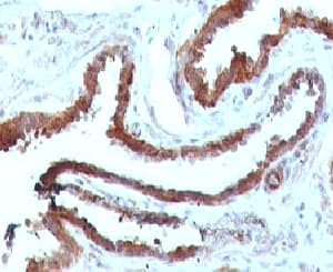 HSPB1 / HSP27 Antibody (clone SRPR27, Ready-to-Use)