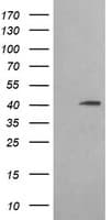 ACAA2 Antibody (clone OTI3C6)