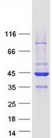 Human RASSF2 Protein (Recombinant Myc-DDK (Flag))